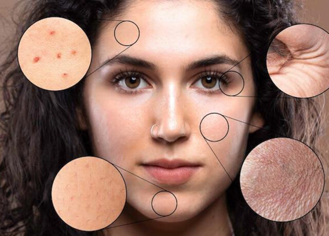 30/05 - SETTIMANA DEL CHECK-UP CUTANEO | Sede di Arzergrande